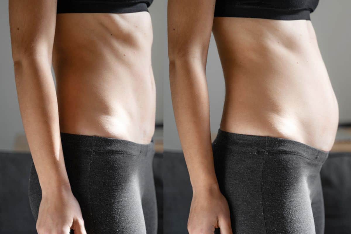 How long does diastasis recti take to improve Cottenham Park?