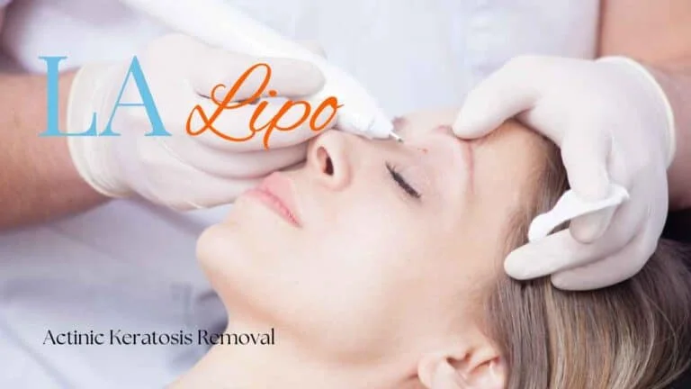 Woman receiving Actinic Keratosis Removal Treatment Cottenham Park