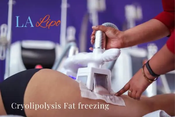women getting fat freezing Cottenham Park