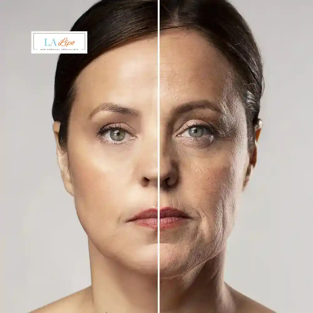 How Can You Tell If Non-Surgical Skin Tightening Is Right for You Cottenham Park?
